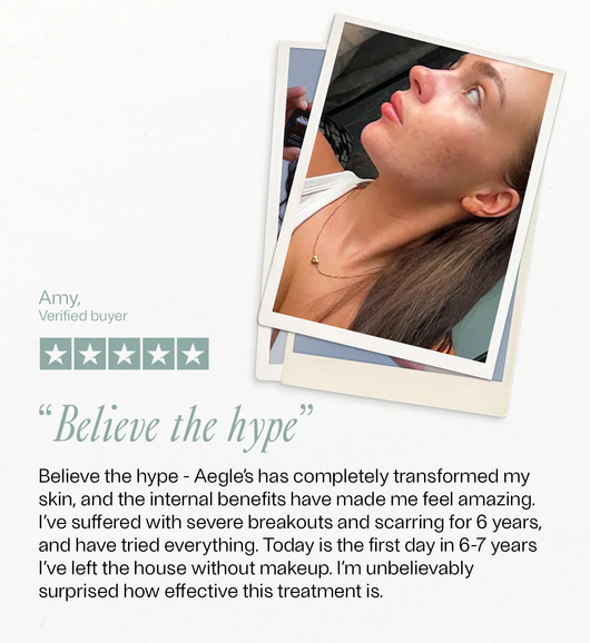 Customer testimonial Amy